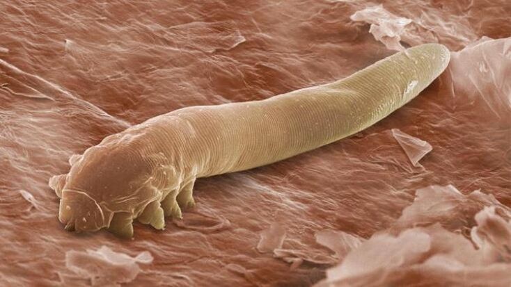 robak żyjący pod ludzką skórą