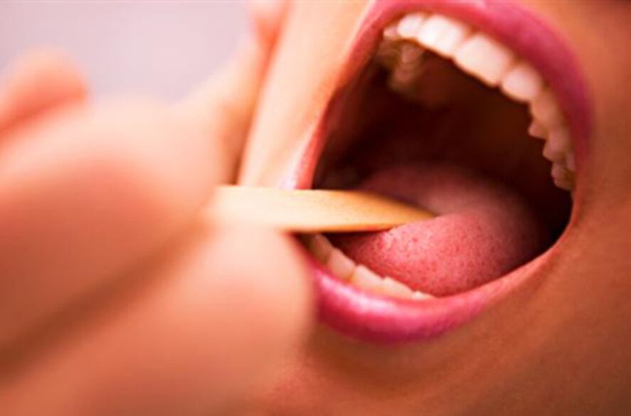 rodzaje pasożytów w jamie ustnej człowieka